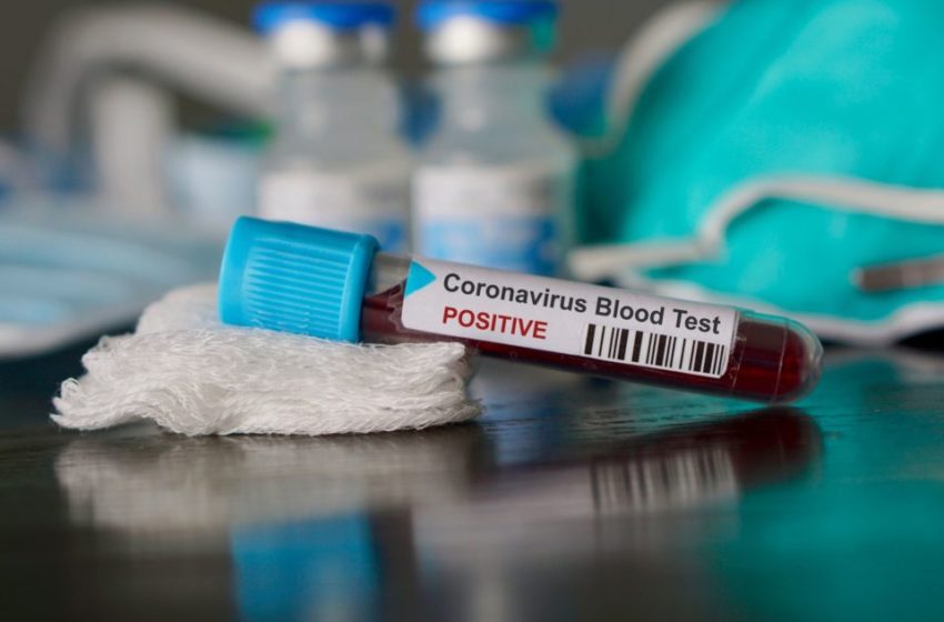 coronavirus 1 850x560 - LUTTE CONTRE LE TRAFIC DE DROGUE Encore une saisie de chanvre indien